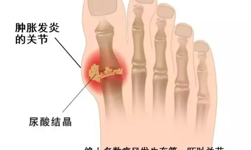 再障病人出血时骨髓有何变化吗-再障病人出血时骨髓有何变化网-分享再障换骨髓能活多久，再障如何恢复骨髓造血功能知识库